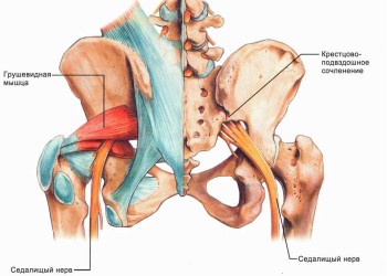 Повреждение седалищного нерва(нейропатия и парез) после эндопротезирования тазобедренного сустава: причины онемения, как лечить 