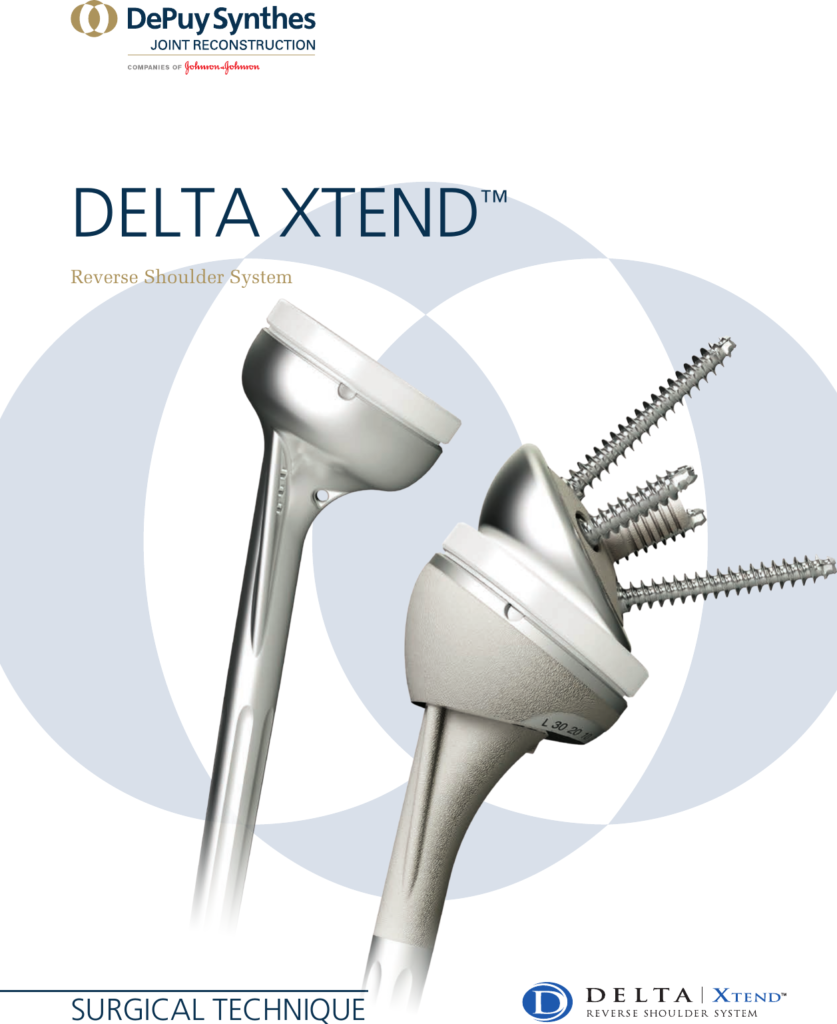 DELTA XTEND™ Reverse Shoulder System