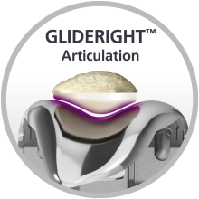 GLIDERIGHT™ Articulation