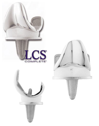 LCS® Knee System