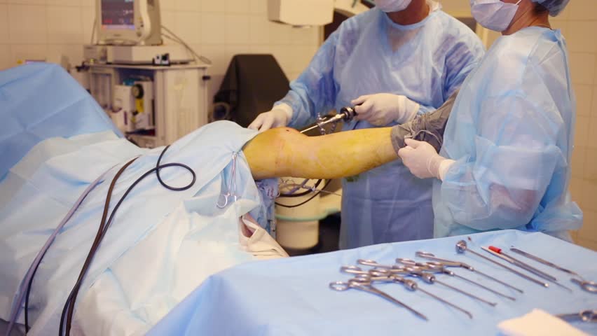 Изображение - Артроскопия передней крестообразной связки коленного сустава idet-operatsiya