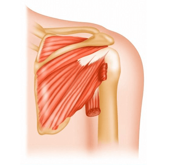 Изображение - Институт плечевого сустава plechevoj