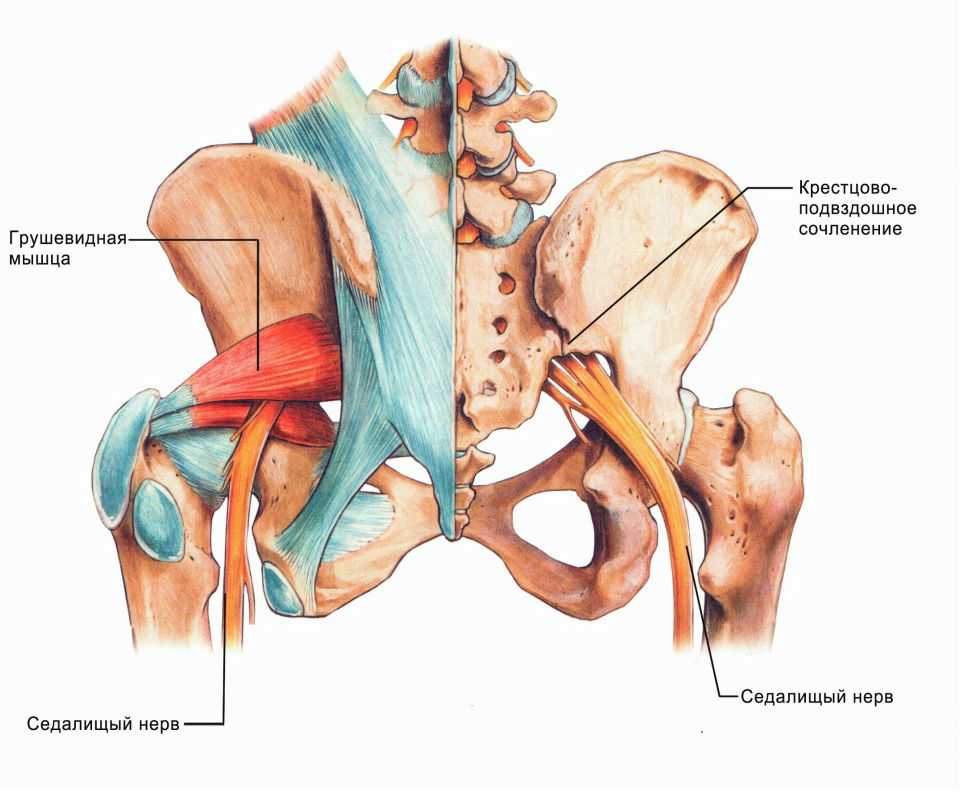 Повреждение седалищного нерва(нейропатия и парез) после эндопротезирования тазобедренного сустава: причины онемения, как лечить 