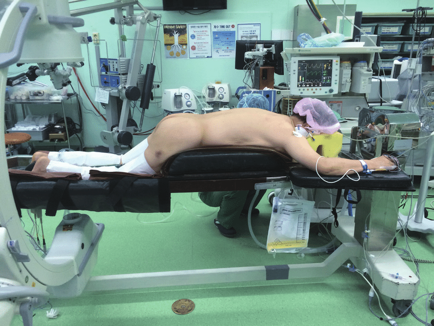 Положение пациента на операционном столе